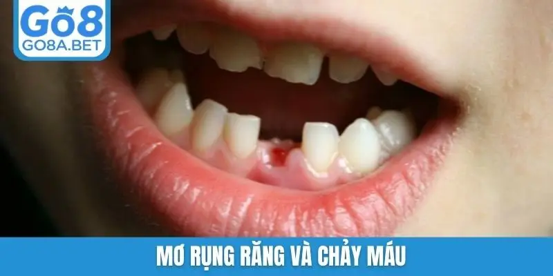 Mơ rụng răng và chảy máu